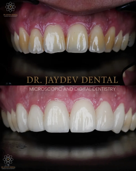 Two men smiling side by side in a dental clinic ad, with the slogan 'Your smile is your strength' and Dr. Jaydev Dental branding.