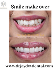 Banner showing before-and-after teeth whitening results with the heading 'Smile make over' for Dr Jay Dev Dental (www.drjaydevdental.com).