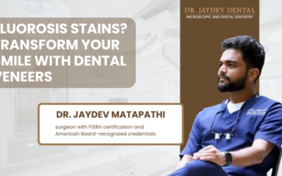 Fluorosis Stains Don’t Need Crowns Anymore — Just the Art of Beautifully Crafted Dental Veneers