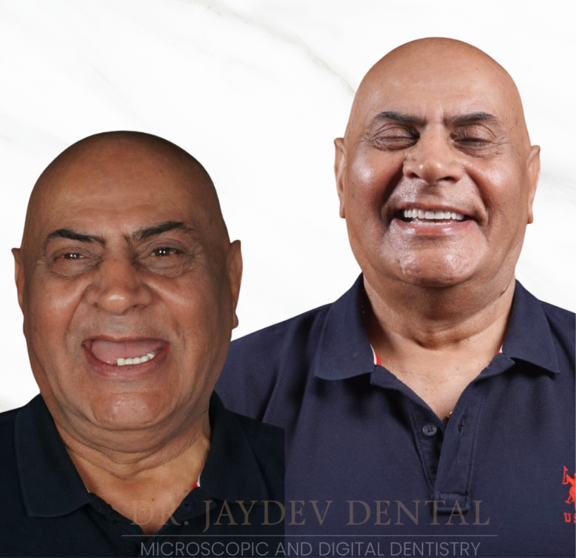 Two smiling men with shaved heads pose together in dark polo shirts, likely a friendly dental clinic team photo with a watermark reading Jaydev Dental.