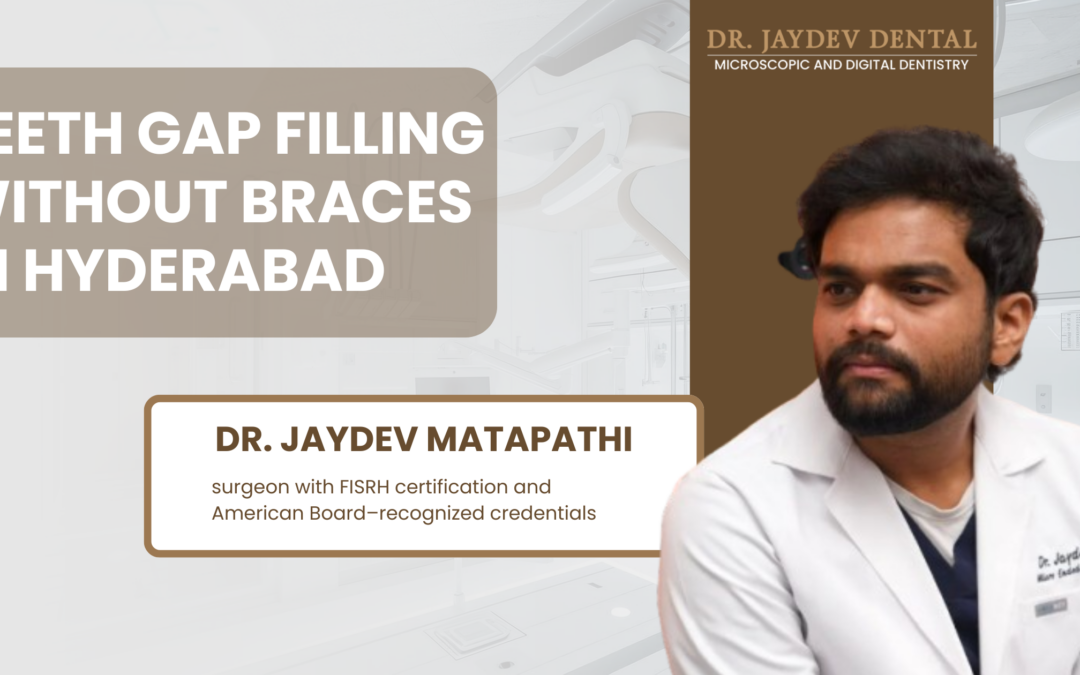 Teeth gap filling without braces in Hyderabad: best options in 2026