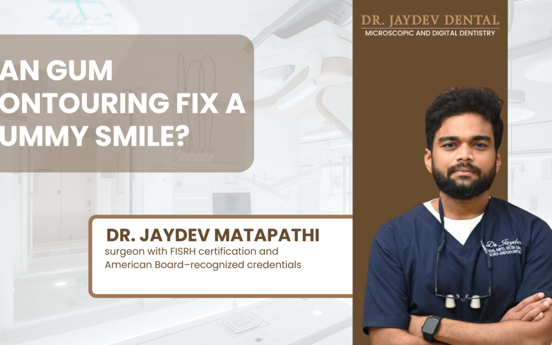 Can Gum Contouring Fix a Gummy Smile by Dr. Jaydev Dental