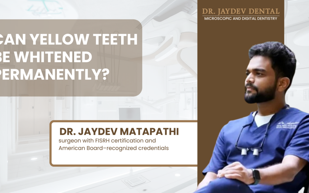 Can Yellow Teeth Be Whitened Permanently by Dr. Jaydev Dental