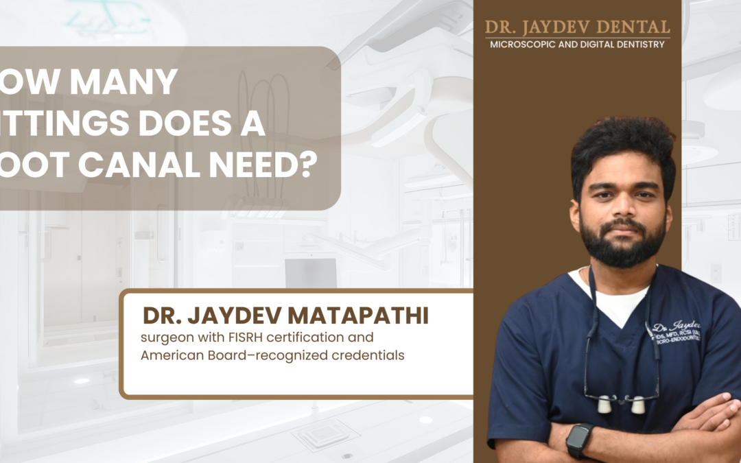 How Many Sittings Does a Root Canal Need by Dr. Jaydev Dental