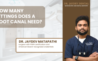 How Many Sittings Does a Root Canal Treatment Require?