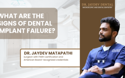 What Are the Signs of Dental Implant Failure?