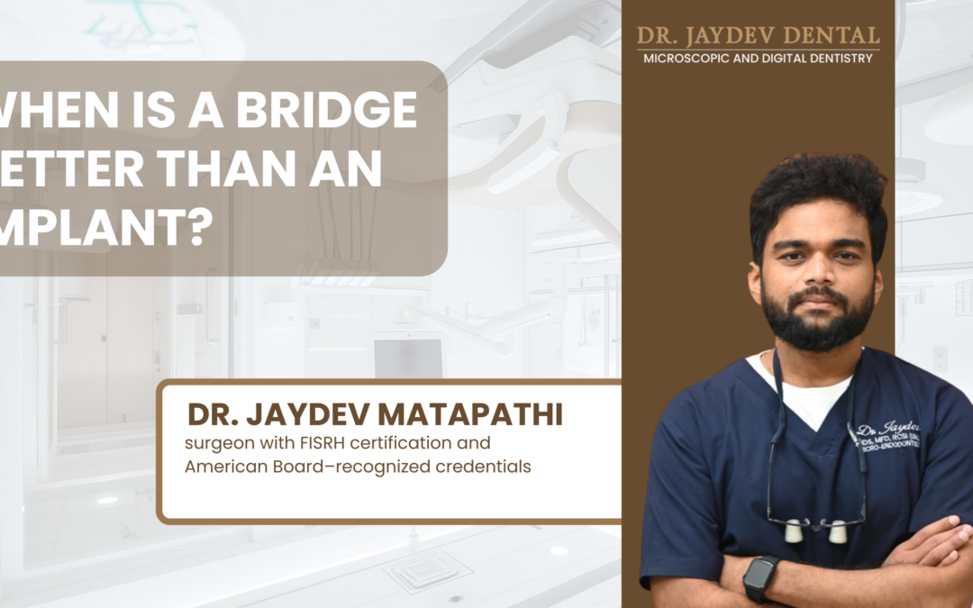 When Is a Bridge Better Than an Implant by Dr. Jaydev Dental
