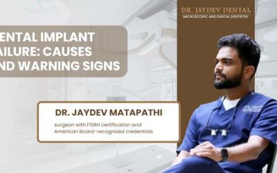 Dental Implant Failure: What Causes It and How to Recognise It Early?