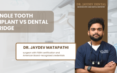 Single-Tooth Implant vs. Dental Bridge: Which Wins?