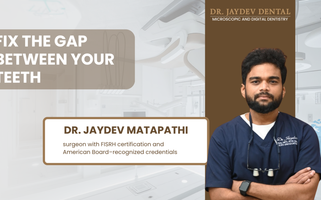How Can You Fix the Gap Between Your Teeth?