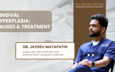 What Is Gingival Hyperplasia and How Is It Treated?
