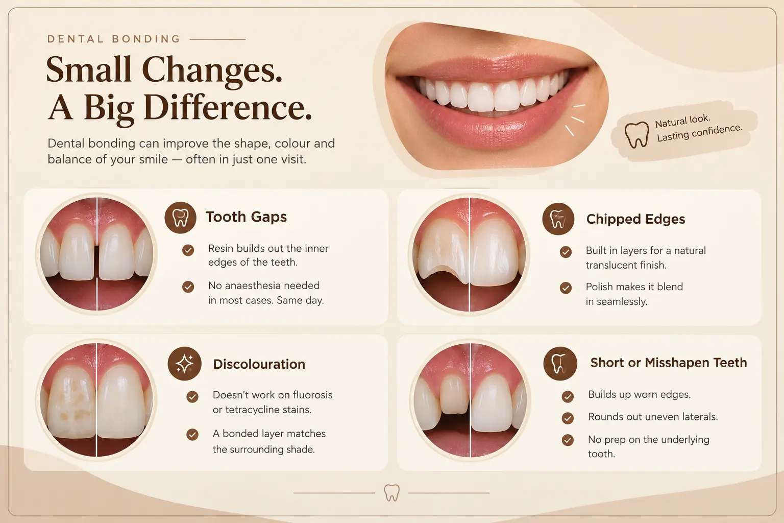 Small Changes A Big Smile Difference